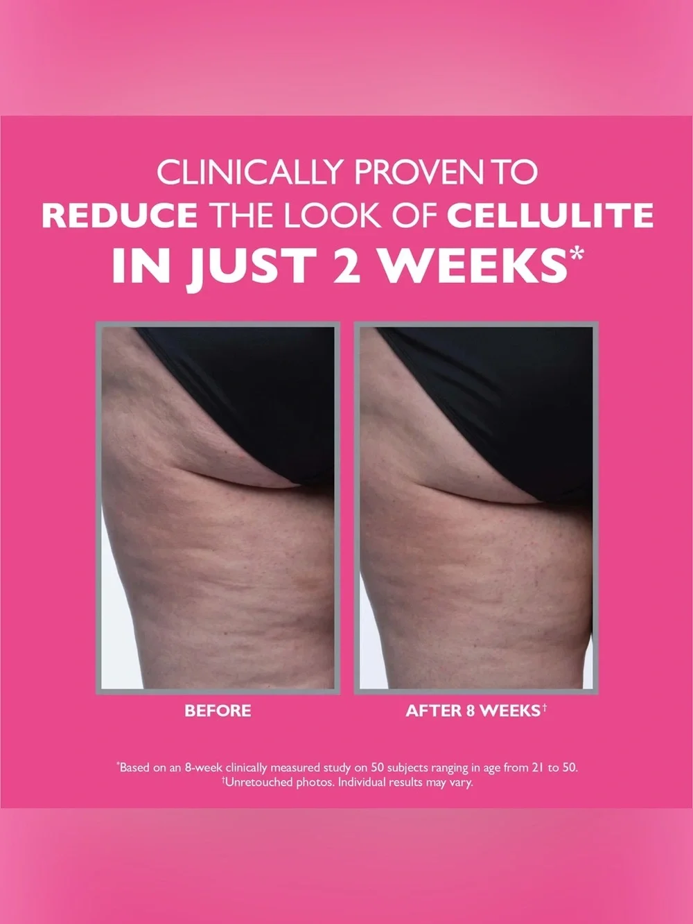 Peter Thomas Roth FirmX Tight & Toned Cellulite Treatment - Yellow